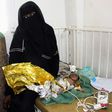 A newborn baby girl suffering from severe malnutrition at a hospital in Yemen's northwestern Hajjah province