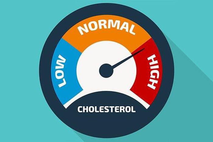 How to diagnose and manage your high cholesterol