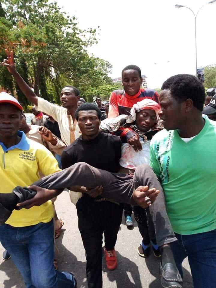 Protesters attacked by police in Abuja