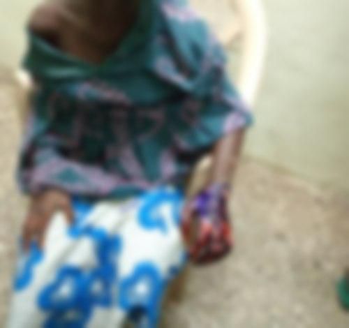 A little girl display a bad injury on her left hand after a punishment by her grandmother who has been arrested alongside an accomplice.