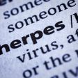 herpes