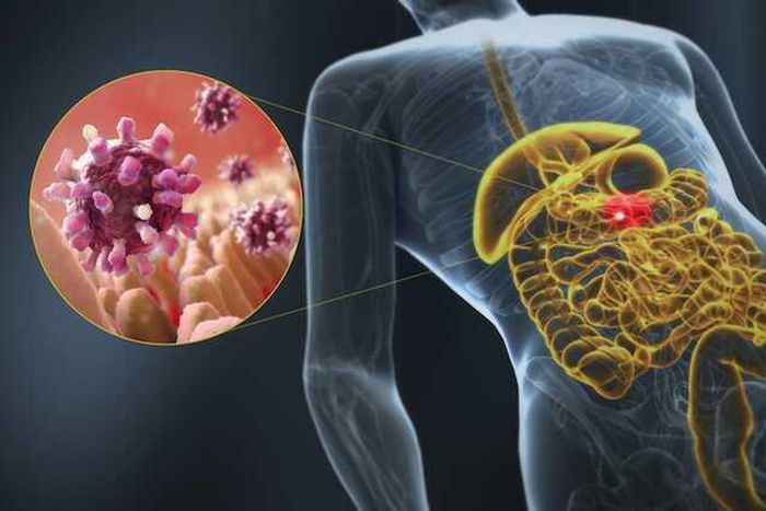 Gastroenteritis, a 3D medical illustration of affected organ highlight
