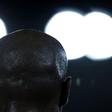 Bald individuals are rich, according to Mozambique superstition and culture