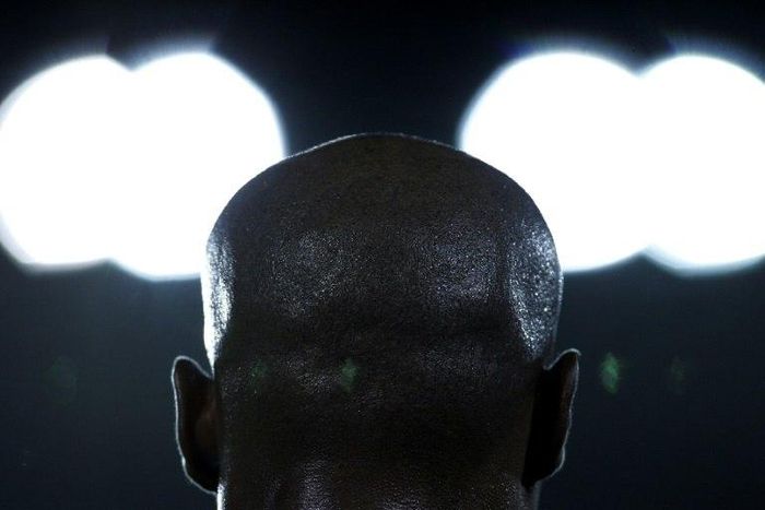 Bald individuals are rich, according to Mozambique superstition and culture