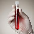 Could a simple blood test determine when you’ll die?
