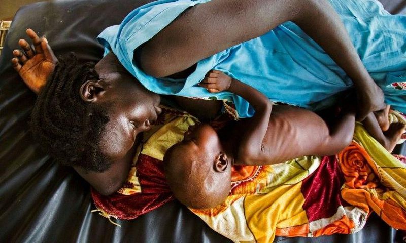 A mother breastfeeds her child suffering from acute malnutrition at a clinic run by Doctors Without Borders (MSF) in Aweil, northern Bahr al-Ghazal, South Sudan