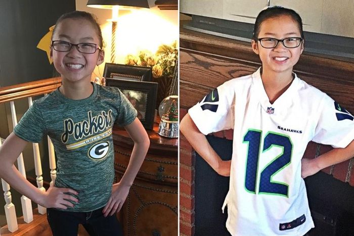 'Yan Biyu sun sake saduwa bayan an raba su a lokacin haihuwa