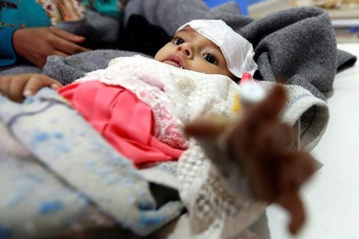 This photo from June 2017 shows an infant suspected of being among Yemen's 320,000 cholera cases in what a UN aid official calls a man-made scandal
