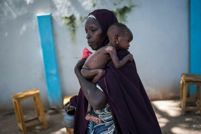 In July, the UN said nearly 250,000 children under five could suffer from severe acute malnutrition this year in Borno state
