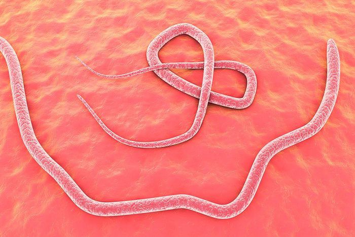 parasitic brain worm