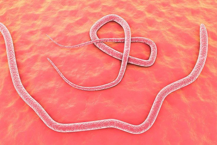 parasitic brain worm