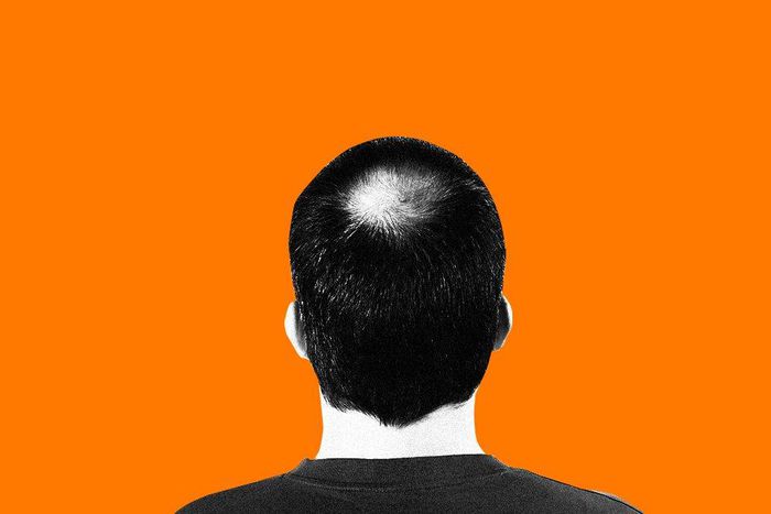 what is dihydrotestosterone