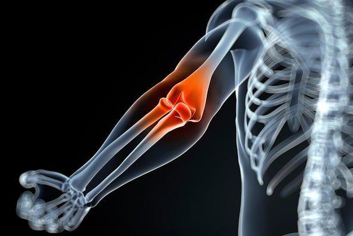 ___7140687___https:______static.pulse.com.gh___webservice___escenic___binary___7140687___2017___8___13___18___joint-pain-myth-lie