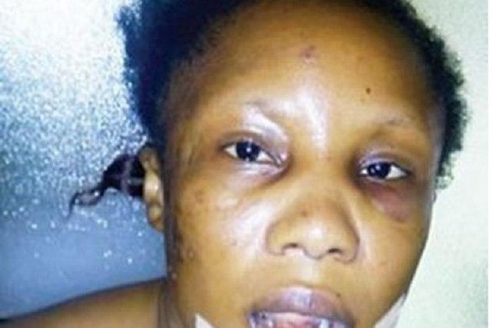 The injured Oluchukwu Ezemaduka