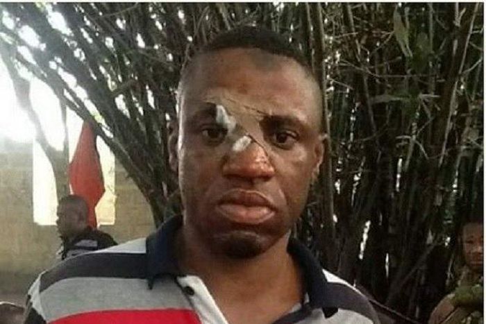 One of the victims of the Itiam community