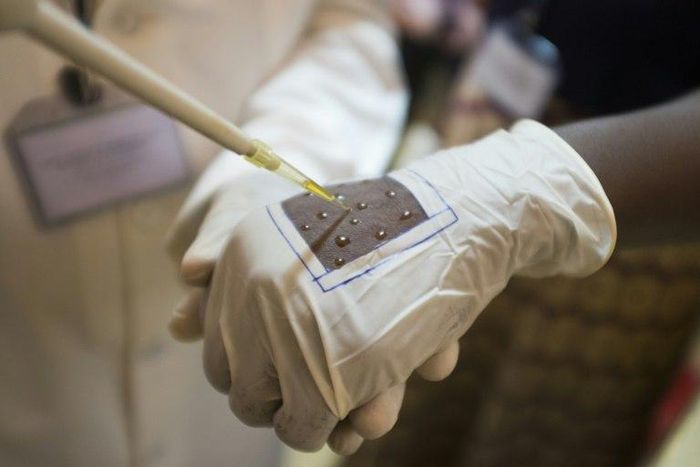 A volunteer at Burkina Faso's National Centre for Malaria Research and Training, puts "Faso Soap" on part of their hand to test its effectiveness