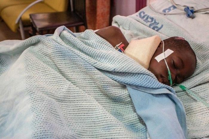 A child is treated in hospital after being injured during a stampede in Malawi's capital Lilongwe on July 6, 2017