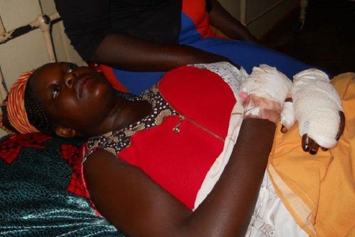 Olivia Nangozi on her hospital bed after her husband slit her neck