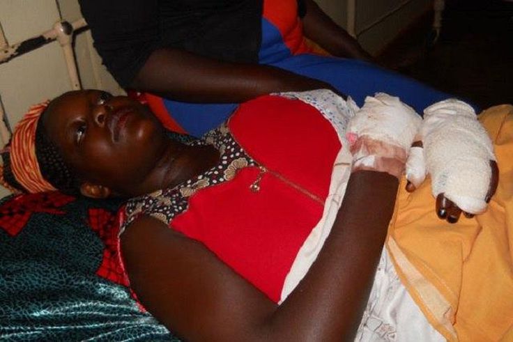 Olivia Nangozi on her hospital bed after her husband slit her neck
