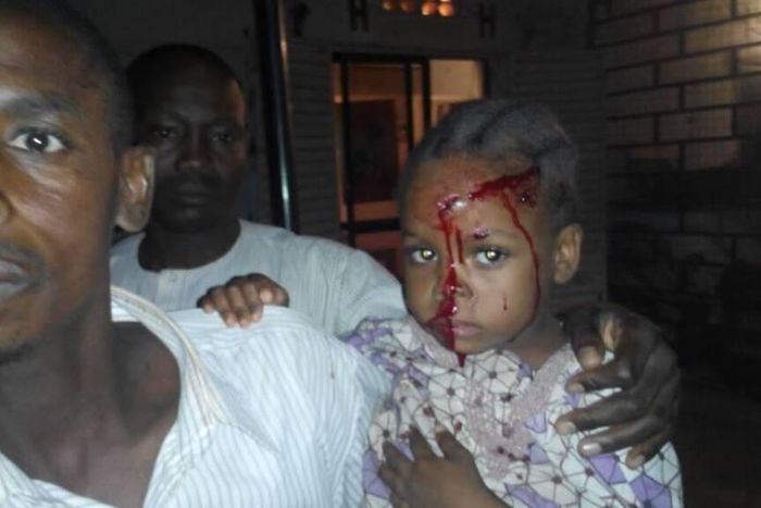 Little girl hit by stray bullet