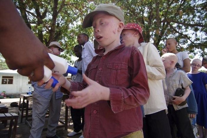 Albino children queue to receive factor-50 sunscreen in Mitindo Primary School in Nyawilimilwa, Mwanza region of Tanzania, November 21, 2009. REUTERS/Katrina Manson