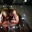A pair of split boxing gloves worn by Muhammad Ali during his 1963 fight against Henry Cooper -- the British boxer won that bout but lost a susequent fight on points