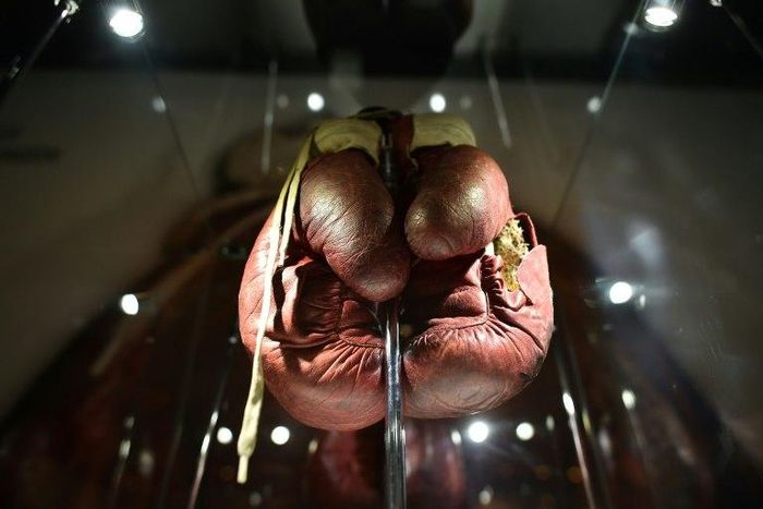 A pair of split boxing gloves worn by Muhammad Ali during his 1963 fight against Henry Cooper -- the British boxer won that bout but lost a susequent fight on points