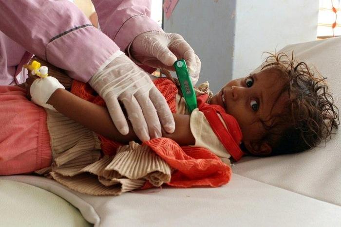 The collapse of Yemen's infrastructure after more than two years of war has made the country's cholera epidemic the worst in the world