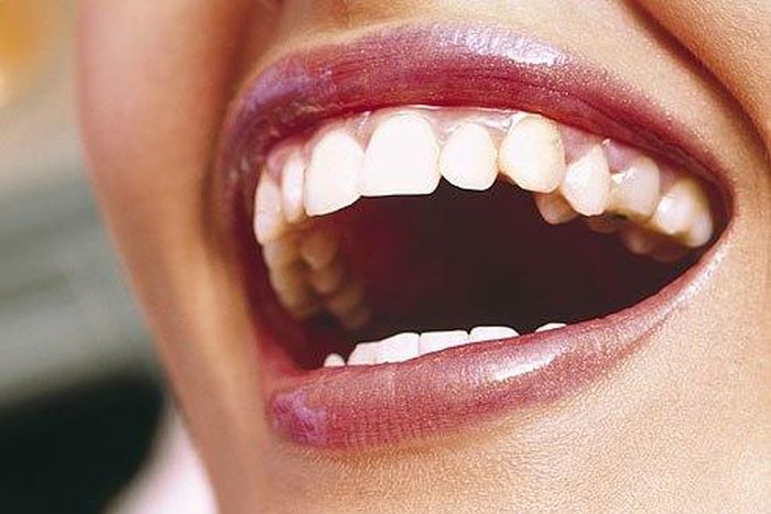 12 Things Your Dentist Knows About You Just By Looking in Your Mouth