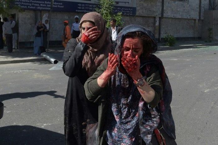 Wounded Afghan women at the site of a car bomb attack in Kabul that killed scores of people on May 31, 2017