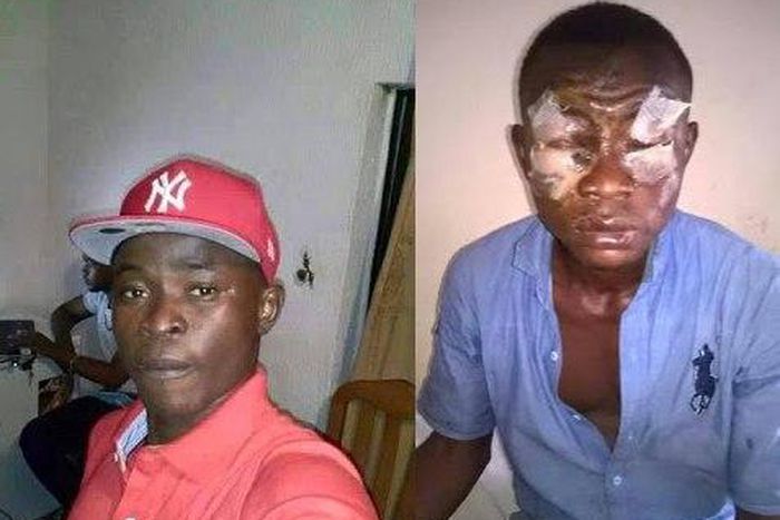 Before and after photo of the victim