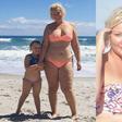 Mom explains stretch marks to her daughter.