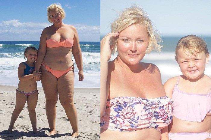 Mom explains stretch marks to her daughter.