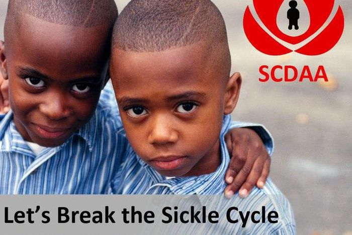 Sickle Cell