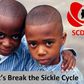 Sickle Cell