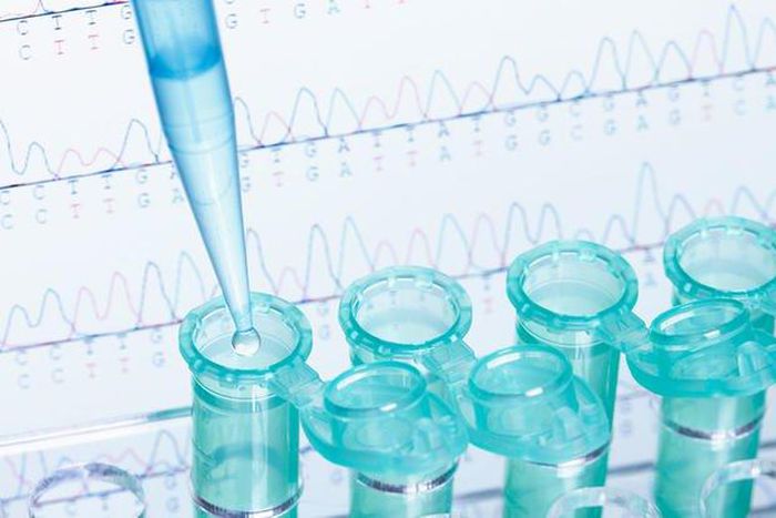 ___7061574___https:______static.pulse.com.gh___webservice___escenic___binary___7061574___2017___7___28___1___can-dna-testing-help-you-lose-weight-main