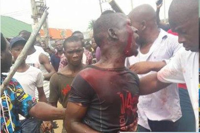 A member of the Badoo gang in a blood-stained shirt.