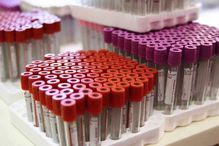 The World Anti-Doping Agency is to discuss the creation of a new, independent drug-testing authority