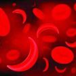 Red blood cells of sickle cell anaemia disease.