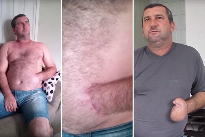 ___6735054___https:______static.pulse.com.gh___webservice___escenic___binary___6735054___2017___5___25___16___man-mangled-hand-sewn-into-stomach