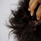 Dandruff/dry scalp is a common lifestyle isse