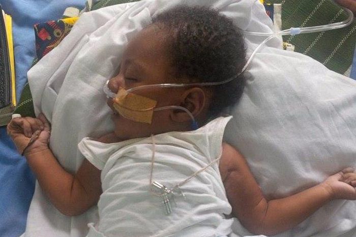 Baby Nathan needs our help to live