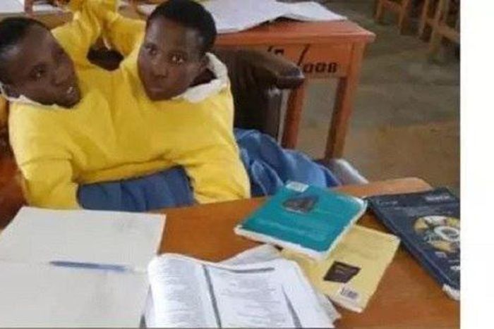 The determined conjoined twins, Maria and Consolata Mwakikuti