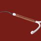 pregnancy iud