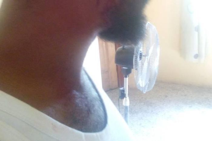 Dr. Abanikanda of University of Osun, after attacks from Air Force personnel.