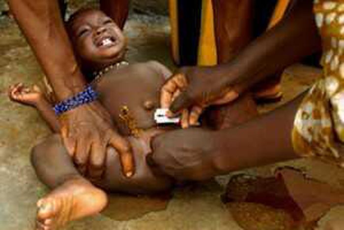 Genital Mutilation