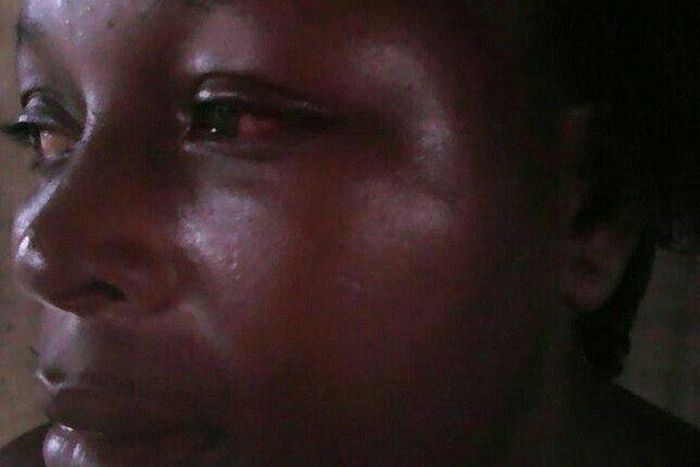 The battered Beauty Wilson