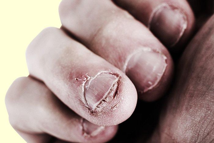 ___6606245___https:______static.pulse.com.gh___webservice___escenic___binary___6606245___2017___4___30___20___nail-biting