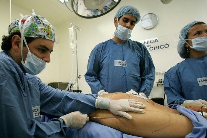 Liposuction remains the second most popular surgical procedure after breast augmentation