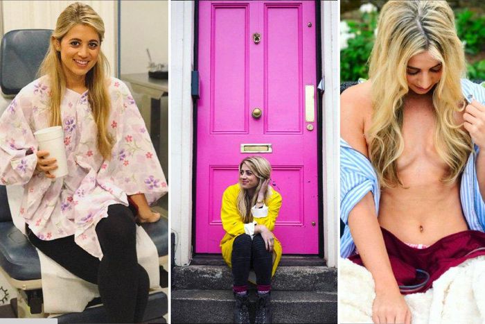 Reality star, Leslie Murphy shows double mastectomy.